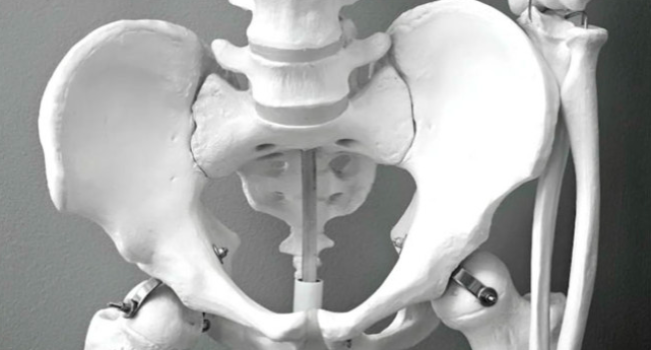 Hati-hati! Kini Banyak Usia Muda Terkena Osteoporosis, Ini 6 Cara Sederhana Perkuat Tulang Anda